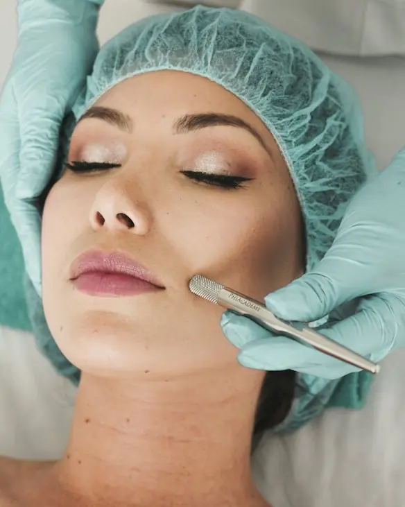 Microneedling