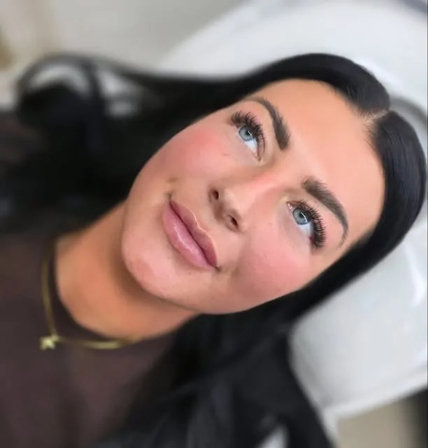 A soft, hydrated lip result
